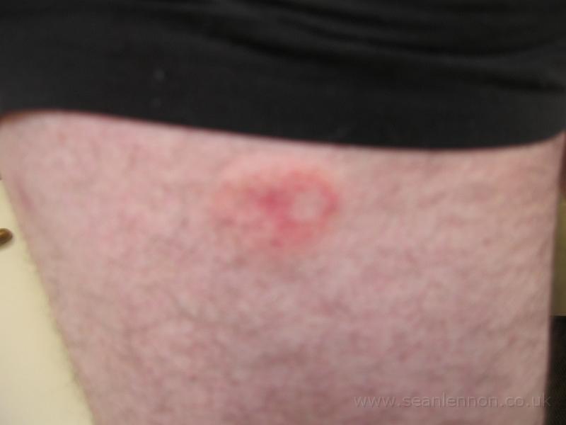 23 March 2005 - Sean's arse 041.jpg